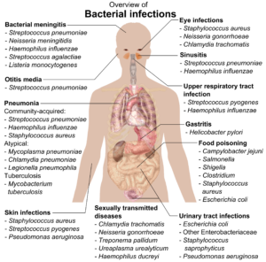 chart of bacterial infections in humans